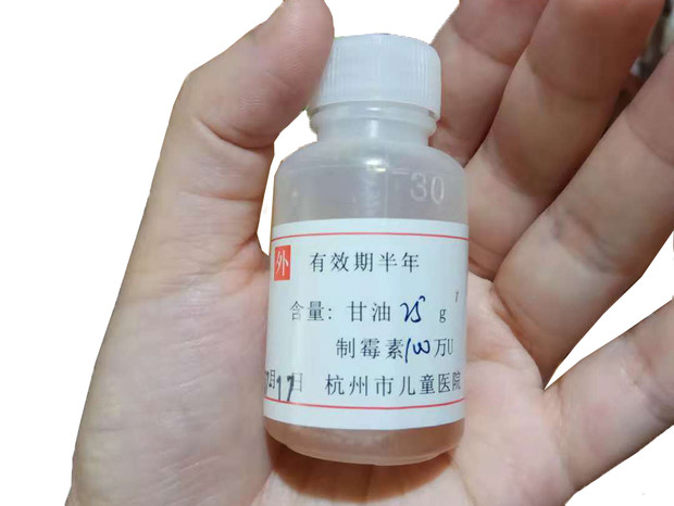 寶寶嘴里長了白色斑點(diǎn)，很可能是鵝口瘡